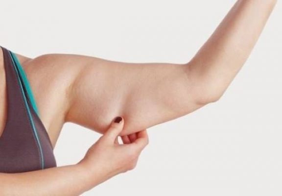 Massage giảm mỡ bắp tay như thế nào để giảm thành công