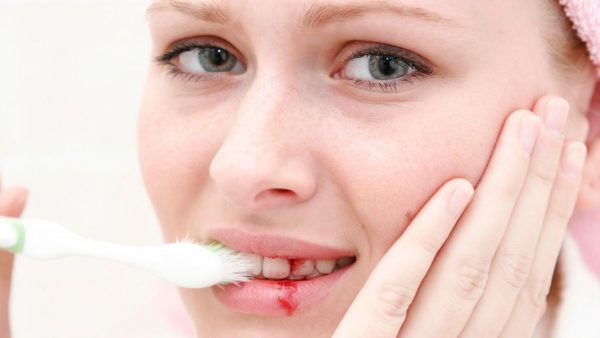 Cách chăm sóc răng miệng cho bà bầu
